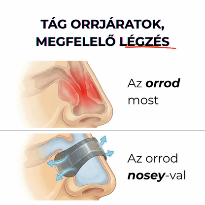 Full alvás, ennek is kell egy név